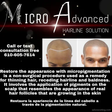 Microadvanced hairline solution, Allentown - 