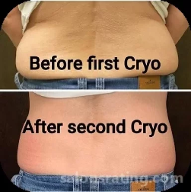 Cryo Curves, Austin - 