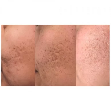 Falcón Skin Therapy, Austin - Photo 5
