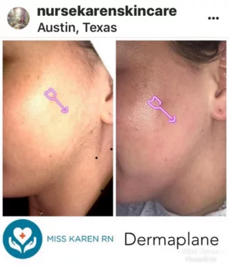 Nurse Karen Skincare & Med Spa, Austin - Photo 7