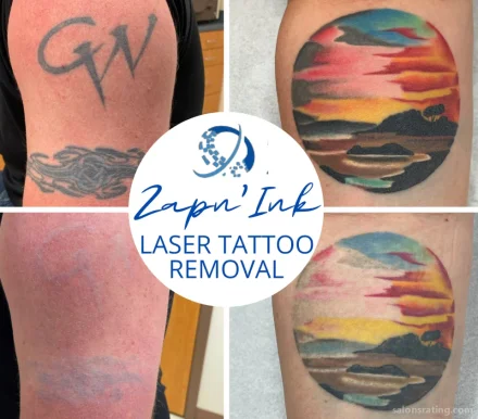 Zapn'Ink Laser Tattoo Removal, Beaumont - Photo 2