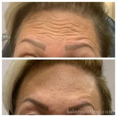 Skin Matrx Integrated Beauty Solutions, Burbank - Photo 6
