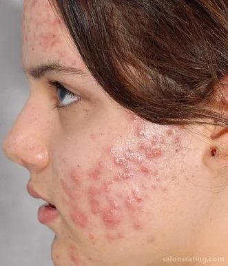 Skin Secrets by Dr. Greta McLaren, Cape Coral - Photo 2