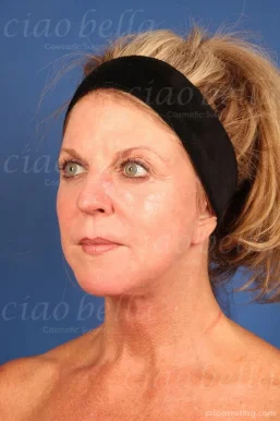Ciao Bella Cosmetic Surgery, Chandler - Photo 7