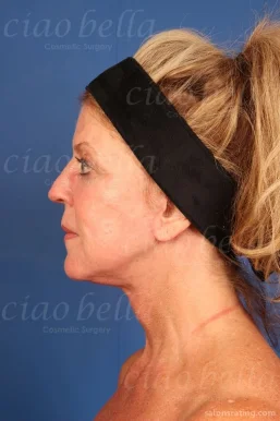 Ciao Bella Cosmetic Surgery, Chandler - Photo 5