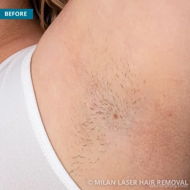 Milan Laser Hair Removal, Chattanooga - Photo 5