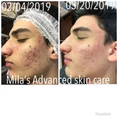 Mila's Advanced Skin Care, Chicago - Photo 2