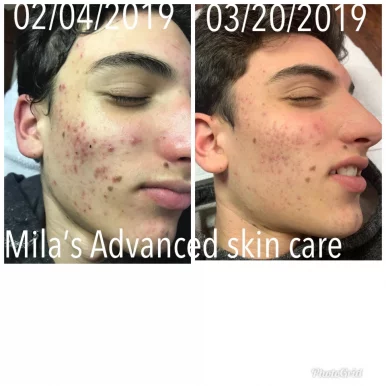 Mila's Advanced Skin Care, Chicago - Photo 1