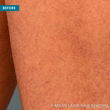 Milan Laser Hair Removal, College Station - Photo 6