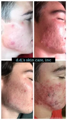D D's Skincare and Facial Salon, Dallas - Photo 6