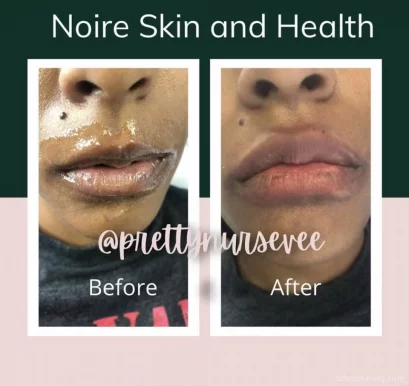 Noire Skin and Health, Dallas - Photo 6