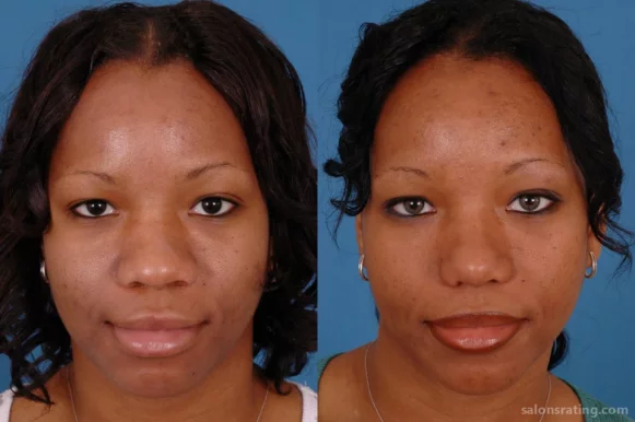 Advanced Facial Plastic Surgery Center, Dallas - Photo 8