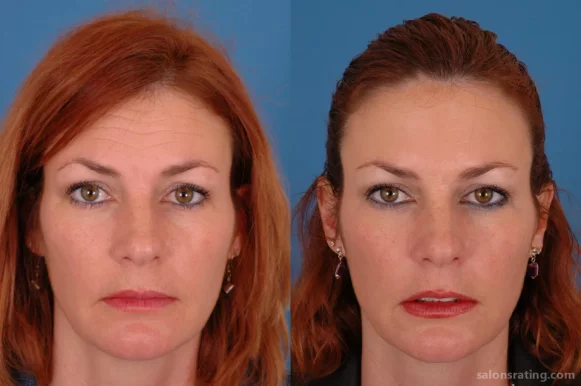 Advanced Facial Plastic Surgery Center, Dallas - Photo 4