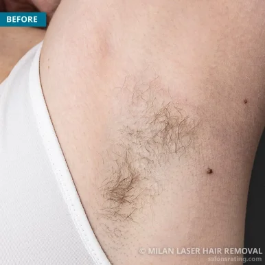 Milan Laser Hair Removal, Fort Collins - Photo 2