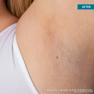 Milan Laser Hair Removal, Fort Collins - Photo 6