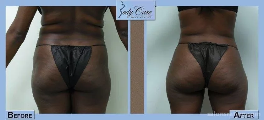Body Care Liposculpture & Anti-Aging Clinic, Fort Lauderdale - Photo 4
