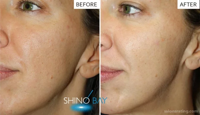 Shino Bay Cosmetic Dermatology & Laser Institute, Fort Lauderdale - Photo 2