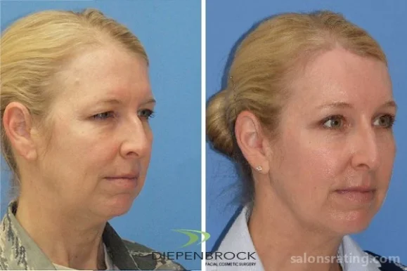 Diepenbrock Facial Cosmetic Surgery, Fort Wayne - Photo 8