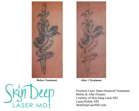 Skin Deep Laser MD, Fort Worth - Photo 1