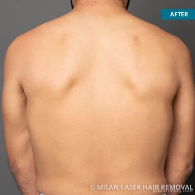 Milan Laser Hair Removal, Fort Worth - Photo 2