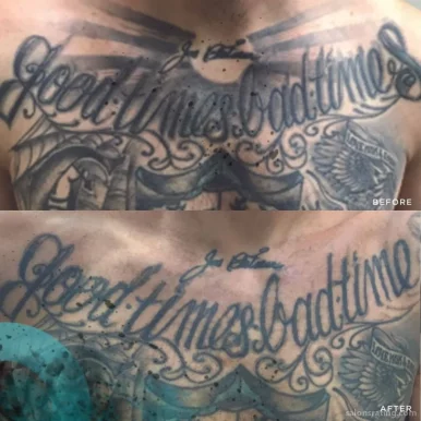 Removery Tattoo Removal & Fading, Fort Worth - Photo 3