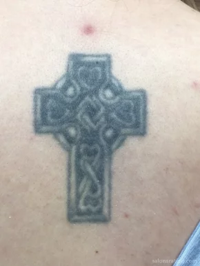 Removery Tattoo Removal & Fading, Houston - Photo 4