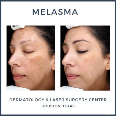 Dermatology & Laser Surgery Center, Houston - Photo 6