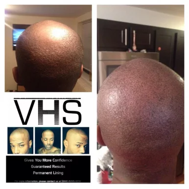 Victory Hairline Solutions, Houston - Photo 4