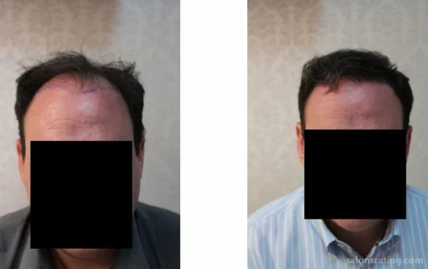 Farhad Ardeshirpour, MD - Ardesh Facial Plastic Surgery, Irvine - Photo 6
