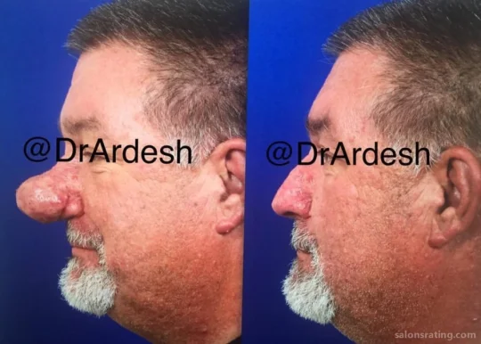 Farhad Ardeshirpour, MD - Ardesh Facial Plastic Surgery, Irvine - Photo 7