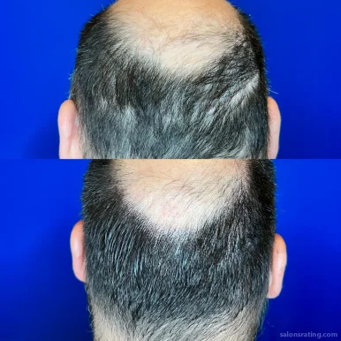 Orange County Hair Restoration, Irvine - Photo 4