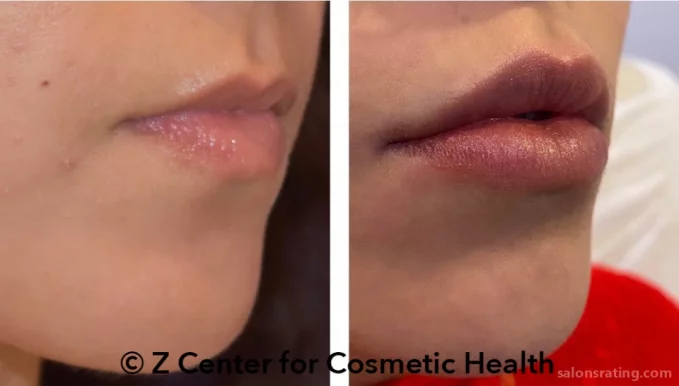Z Center for Cosmetic Health, Los Angeles - Photo 8
