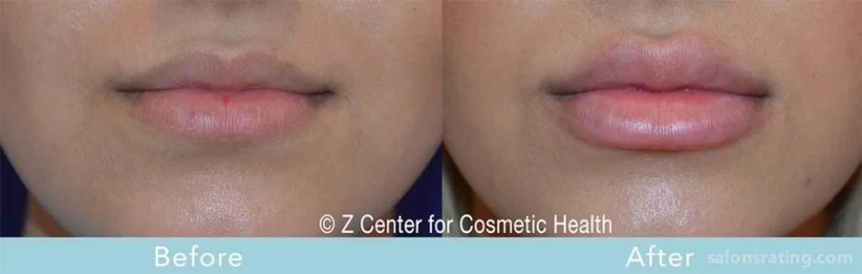 Z Center for Cosmetic Health, Los Angeles - Photo 3