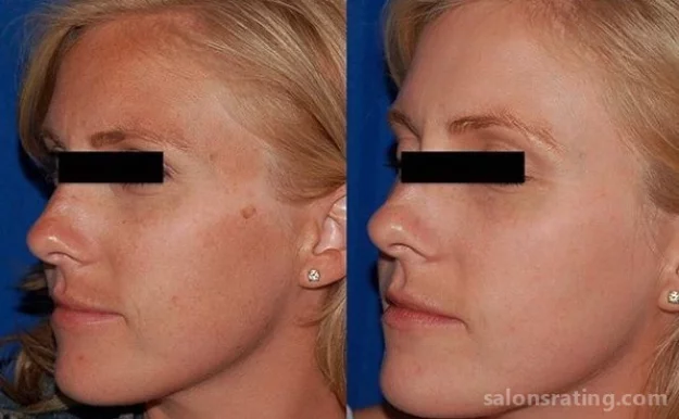 Honest Dermatology Skin and Laser Center, Los Angeles - Photo 4