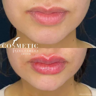 Cosmetic Injectables Center, Los Angeles - Photo 1