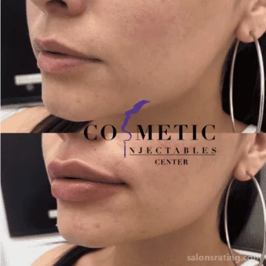 Cosmetic Injectables Center, Los Angeles - Photo 5