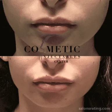 Cosmetic Injectables Center, Los Angeles - Photo 4