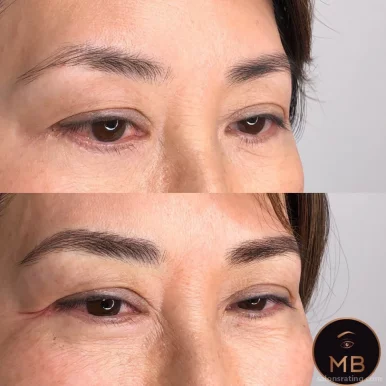 Beverly Microblading Center, Los Angeles - Photo 5