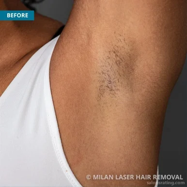 Milan Laser Hair Removal, Lexington - Photo 7