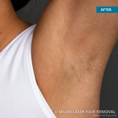 Milan Laser Hair Removal, Madison - Photo 4