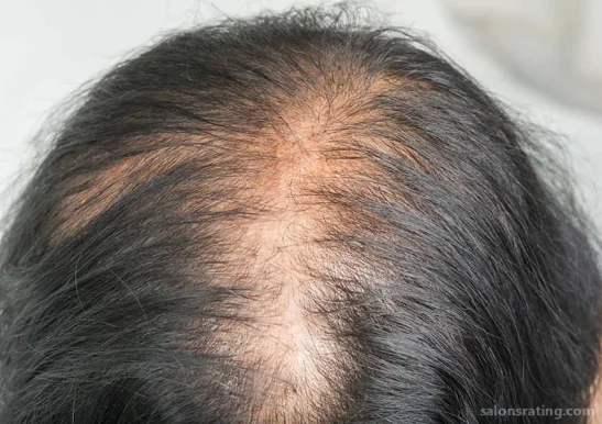Capilia Madison - Hair Loss Solutions, Madison - Photo 3