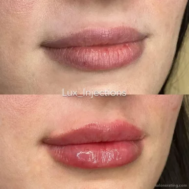 Lux Injections, Mesa - Photo 1