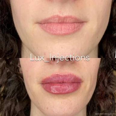 Lux Injections, Mesa - Photo 2