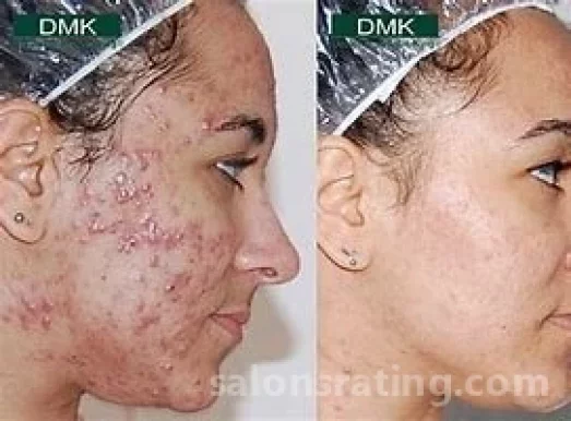 Skin Revision Technologies, Mesa - Photo 4