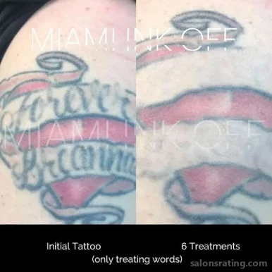 Miami Ink Off Tattoo Removal Clinic, Miami - Photo 3
