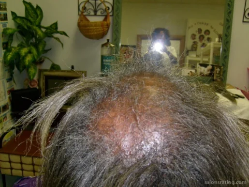 Extream Hair loss Units, Mobile - Photo 2