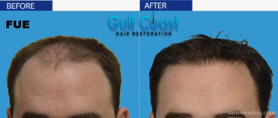 Gulf Coast Hair Restoration, New Orleans - Photo 3
