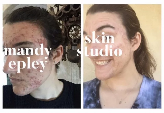 Mandy Epley Skin Studio, New Orleans - Photo 4