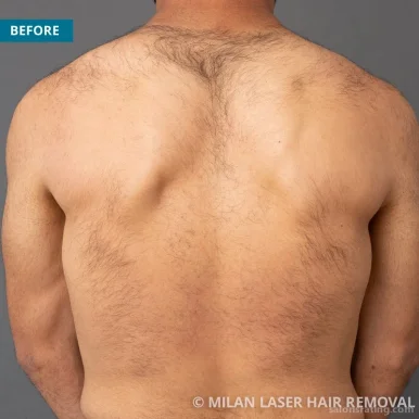 Milan Laser Hair Removal, Norman - Photo 8