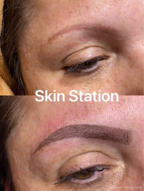 Skin Station, Forest Ave, New York City - Photo 1